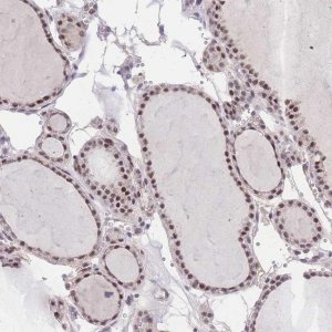 Anti-PUS10 antibody produced in rabbit 