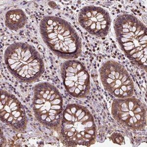 Anti-PUS7L antibody produced in rabbit 