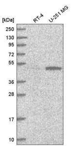 Anti-PWP1 antibody produced in rabbit HPA038708-100UL