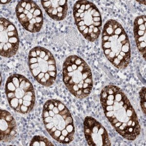 Anti-PWP2 antibody produced in rabbit HPA024573-100UL
