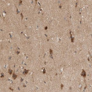 Anti-PXK antibody produced in rabbit 