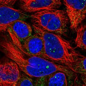 Anti-PXMP4 antibody produced in rabbit 