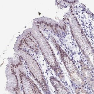 Anti-PYCRL antibody produced in rabbit 
