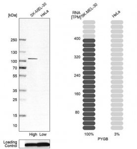 Anti-PYGB antibody produced in rabbit 