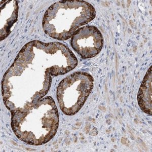 Anti-PYGB antibody produced in rabbit 