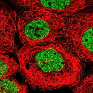 Anti-PYURF antibody produced in rabbit HPA036455-100UL