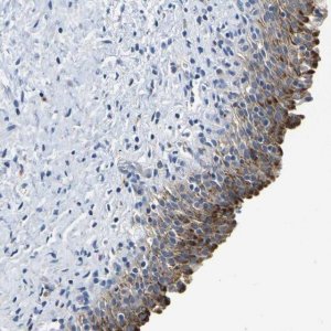 Anti-QRFPR antibody produced in rabbit 