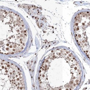 Anti-QRICH1 antibody produced in rabbit 