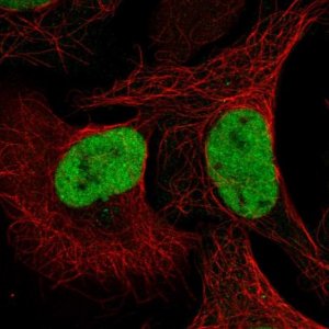 Anti-QRICH1 antibody produced in rabbit 