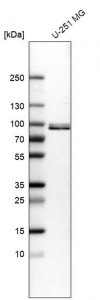 Anti-QSOX1 antibody produced in rabbit 