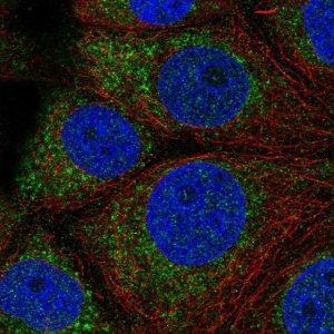 Anti-QTRT1 antibody produced in rabbit 