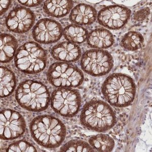 Anti-R3HDM2 antibody produced in rabbit 