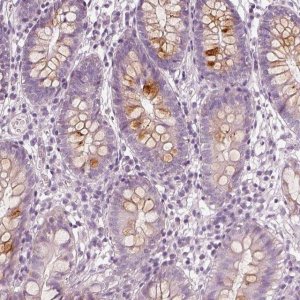Anti-R3HDML antibody produced in rabbit 
