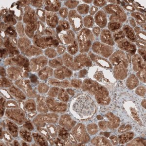 Anti-RAB11FIP3 antibody produced in rabbit 