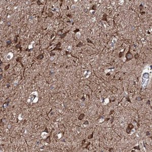 Anti-RAB12 antibody produced in rabbit 