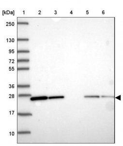 Anti-RAB1A antibody produced in rabbit 