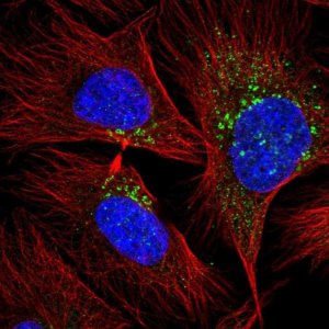 Anti-RAB20 antibody produced in rabbit 