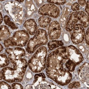 Anti-RAB3GAP2 antibody produced in rabbit 