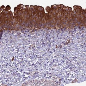 Anti-RABEP2 antibody produced in rabbit 