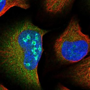 Anti-RABGAP1L antibody produced in rabbit 
