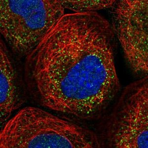 Anti-RABGGTB antibody produced in rabbit HPA026585-100UL