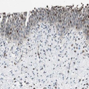 Anti-RAD1 antibody produced in rabbit 