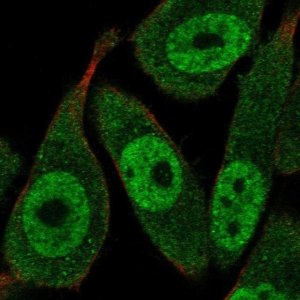 Anti-RAD23A antibody produced in rabbit 