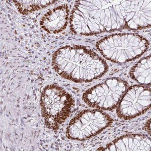 Anti-RAD50 antibody produced in rabbit 