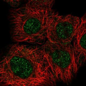 Anti-RAD50 antibody produced in rabbit 