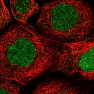 Anti-RAD51AP1 antibody produced in rabbit HPA051499-100UL