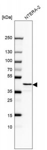 Anti-RAD51AP1 antibody produced in rabbit HPA051499-100UL