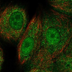 Anti-RAD51C antibody produced in rabbit 