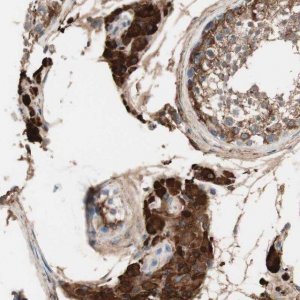 Anti-RAD54B antibody produced in rabbit 