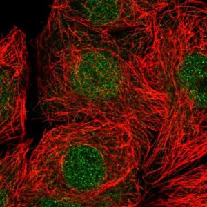 Anti-RAD9A antibody produced in rabbit 