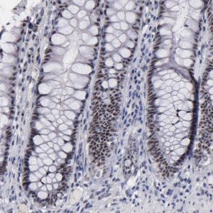Anti-RAF1 antibody produced in rabbit 