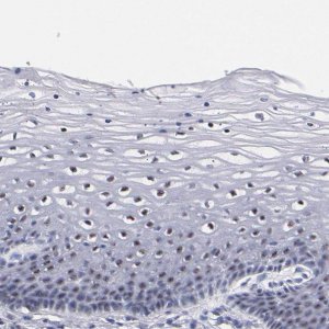 Anti-RAF1 antibody produced in rabbit 