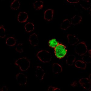 Anti-RAG1 antibody produced in rabbit 