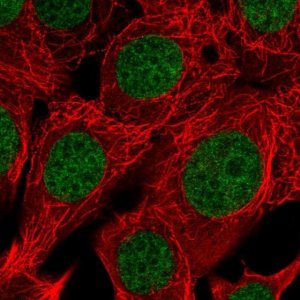 Anti-RAI1 antibody produced in rabbit 