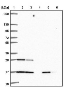 Anti-RALA antibody produced in rabbit 