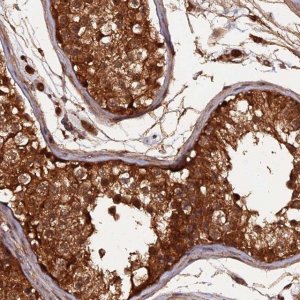Anti-RALGAPA2 antibody produced in rabbit 