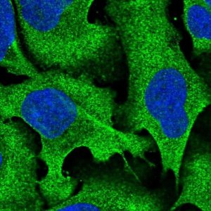 Anti-RALGAPA2 antibody produced in rabbit 