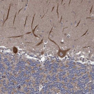 Anti-RALGAPB antibody produced in rabbit 