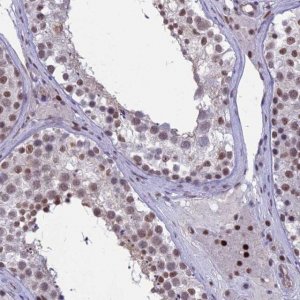 Anti-RANBP3 antibody produced in rabbit 