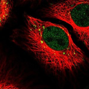 Anti-RANBP6 antibody produced in rabbit 