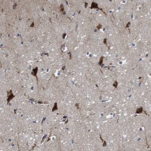 Anti-RAP1GAP2 antibody produced in rabbit HPA022896-100UL