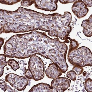 Anti-RAPGEF4 antibody produced in rabbit 