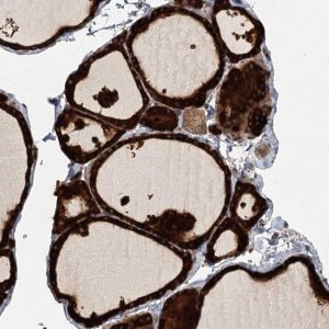 Anti-RAPGEF6 antibody produced in rabbit 