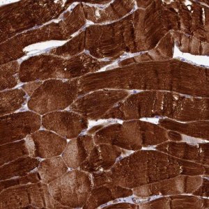 Anti-RAPSN antibody produced in rabbit 