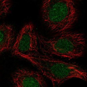 Anti-RARA antibody produced in rabbit 