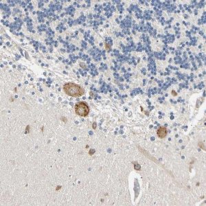 Anti-RARS antibody produced in rabbit 